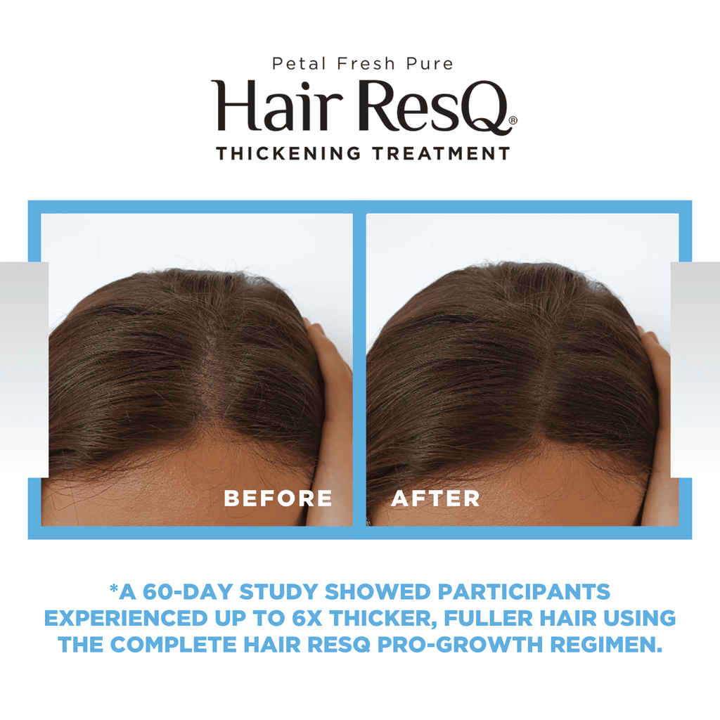 Petal Fresh Hair ResQ Thickening Conditioner, Advanced Biotin Pro-Growth Formula for All Hair Types, 12 fl oz