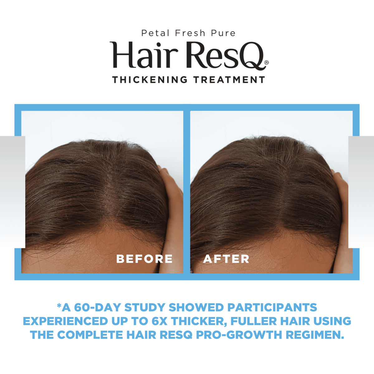 Petal Fresh Hair ResQ Thickening Conditioner, Advanced Biotin Pro-Growth Formula for All Hair Types, 12 fl oz