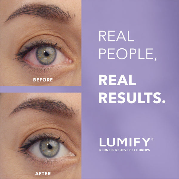 LUMIFY Eye Drops for Redness Relief and Whiter and Brighter Looking Eyes, .25 fl oz (7.5 ml)