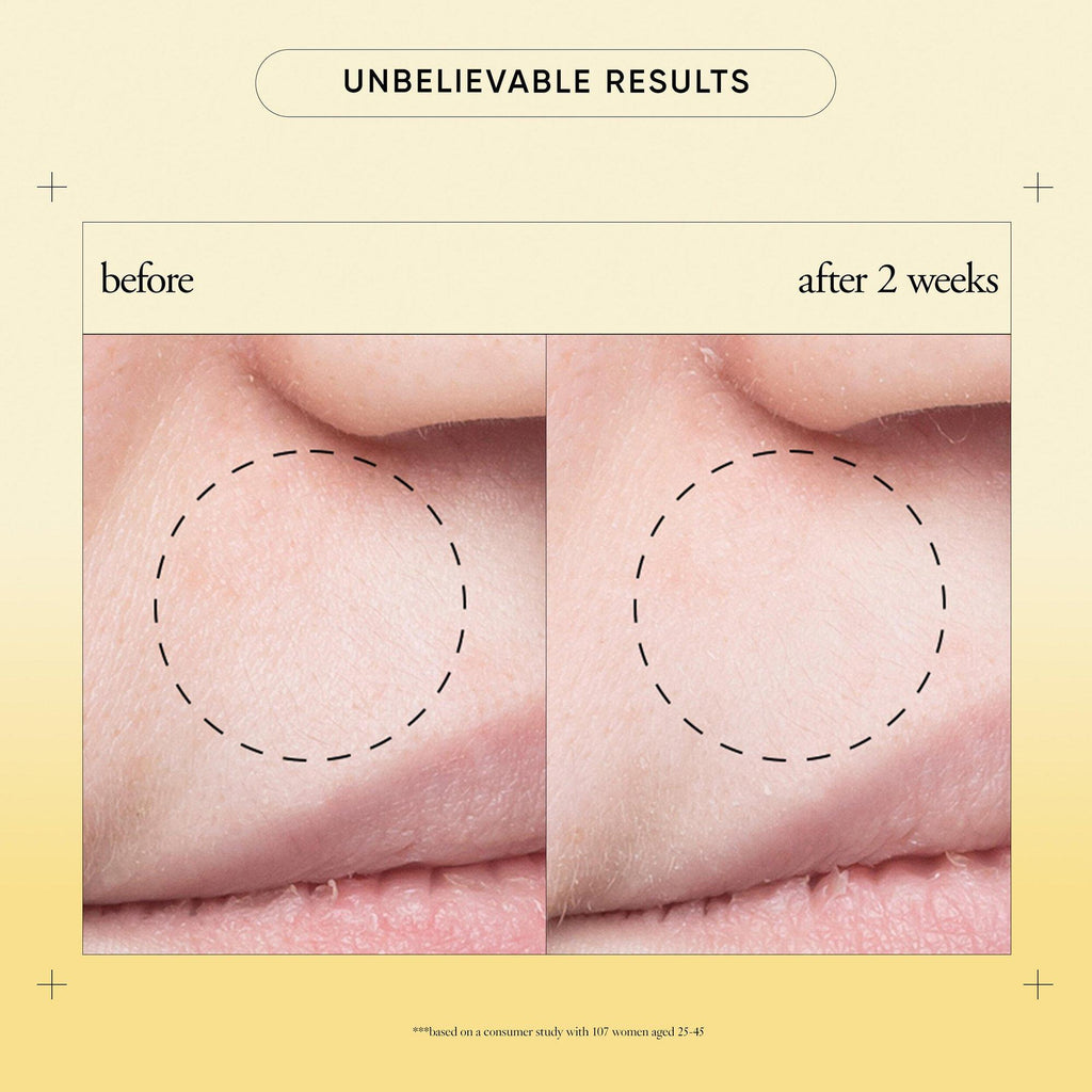 Purity Made Simple Pore Extractor Clay Mask