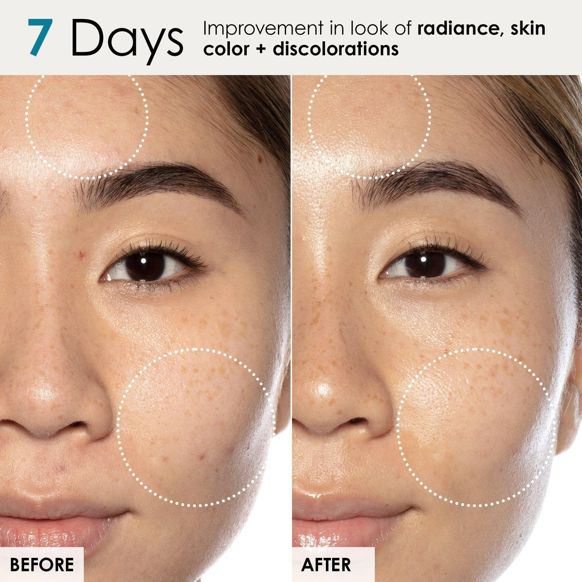 Good Genes All-In-One Lactic Acid Treatment