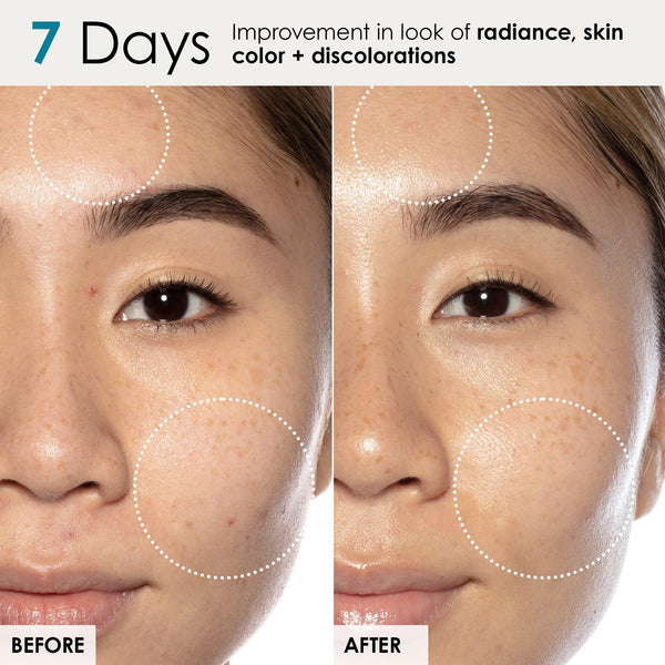 Good Genes All-In-One Lactic Acid Treatment
