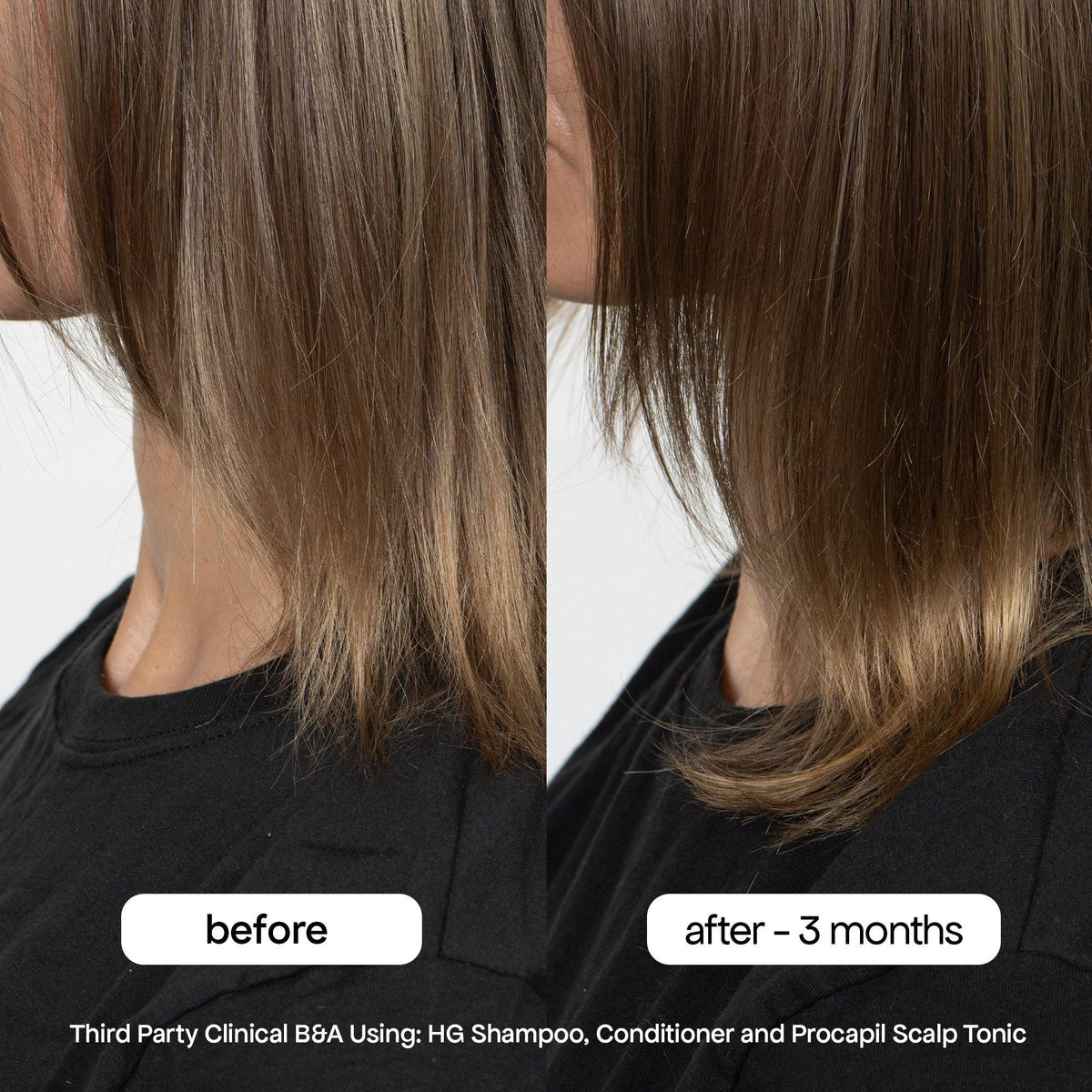 Procapil Hair Tonic Scalp Serum for Thinning Hair