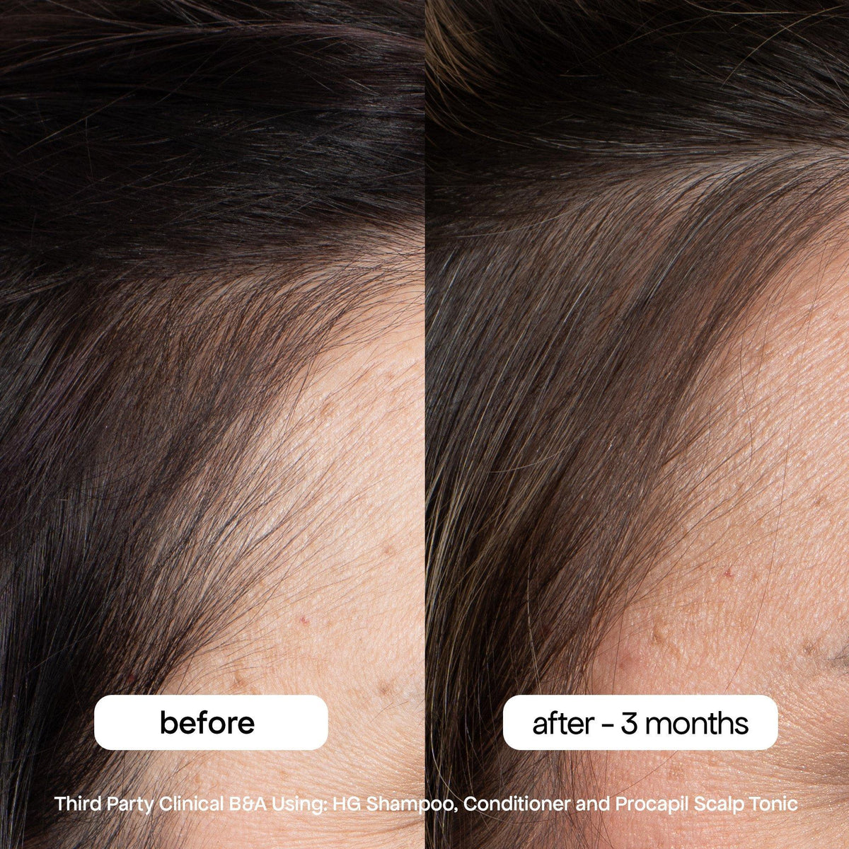 Procapil Hair Tonic Scalp Serum for Thinning Hair