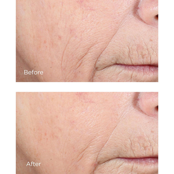 Vitamin C Ester CCC+ Ferulic Brightening Complex 20%