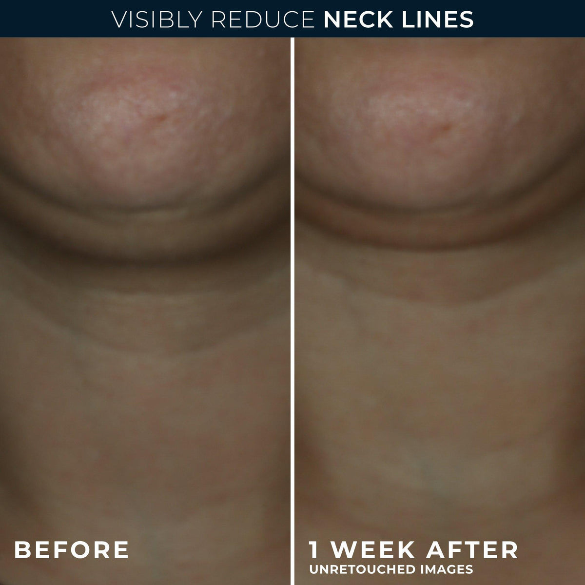 Derm Correxion Contour Cream for Face and Neck