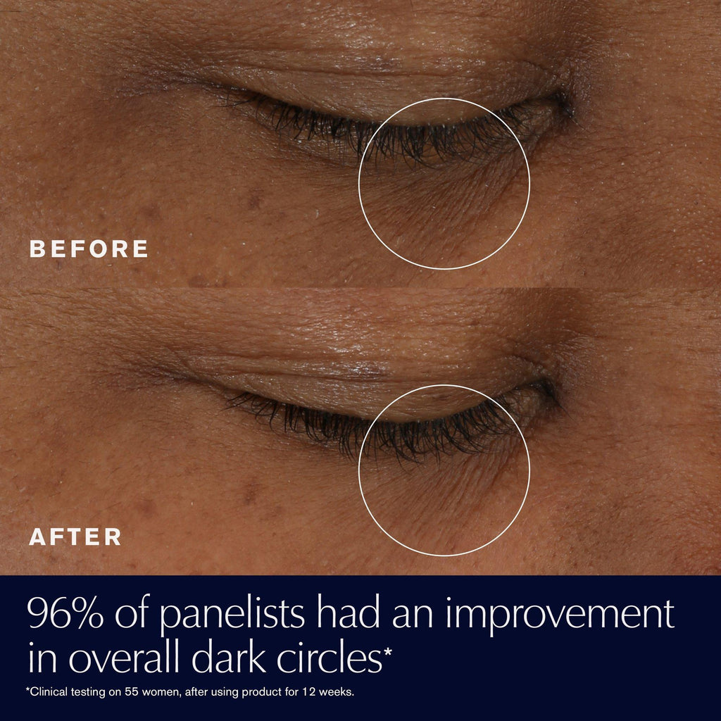 Advanced Night Repair Eye Gel-Cream for Dark Circles