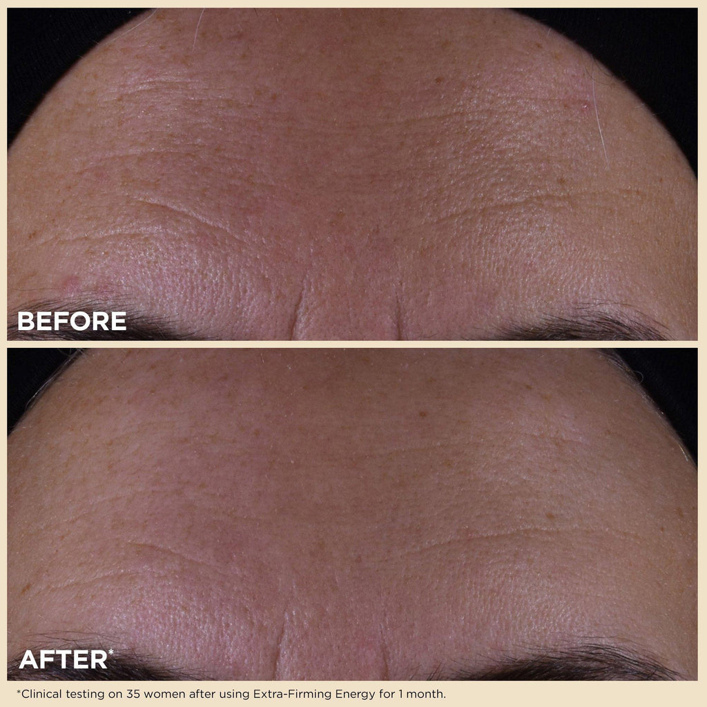 Extra-Firming Energy Refillable Moisturizer