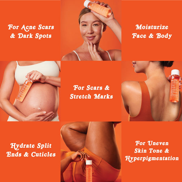 Bio-Oil Skincare Body Oil for Scars and Stretch Marks, Serum Hydrates Skin, 4.2 fl oz