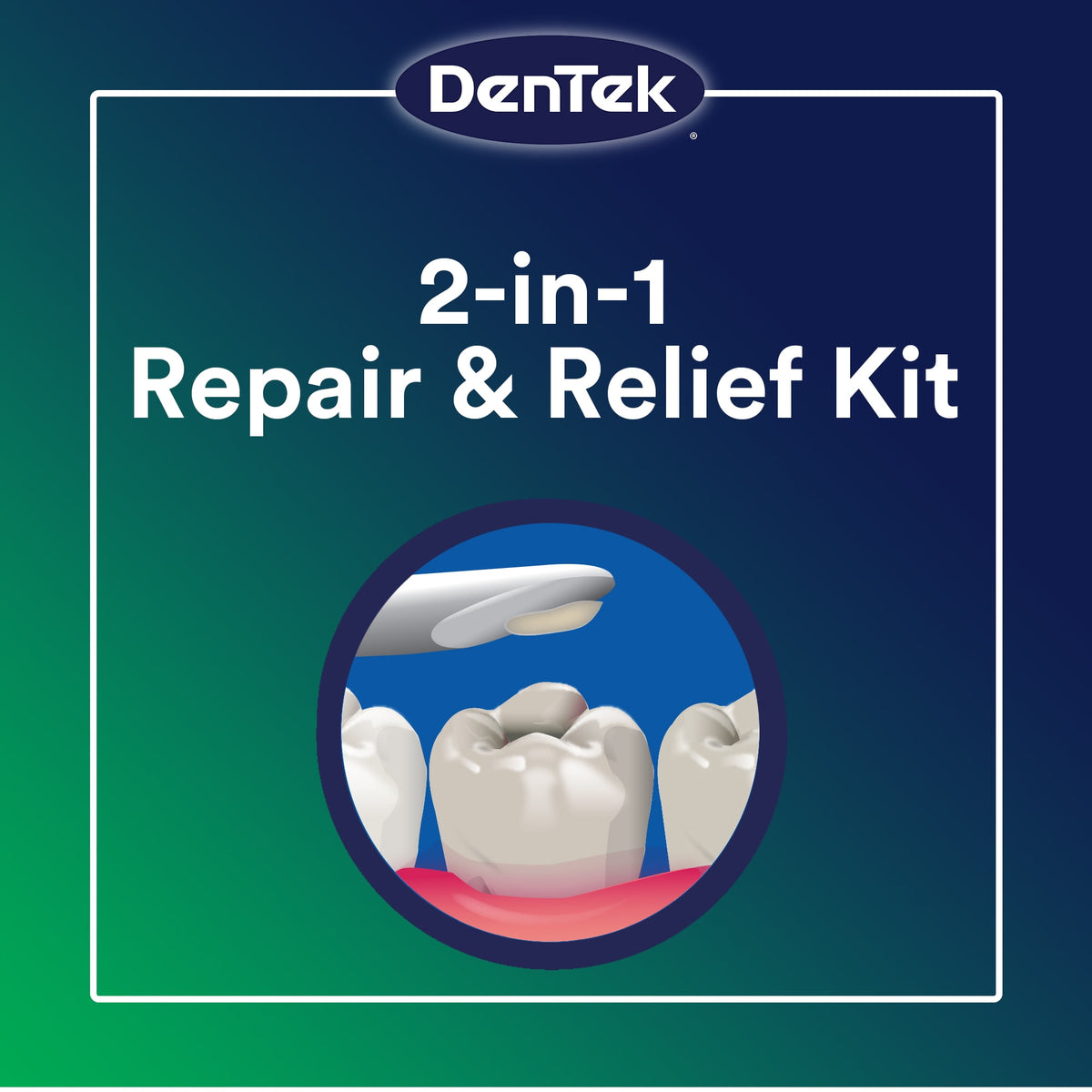 DenTek Temparin Max Advanced Tooth Repair Kit, Loose Cap Set, 13 Repairs