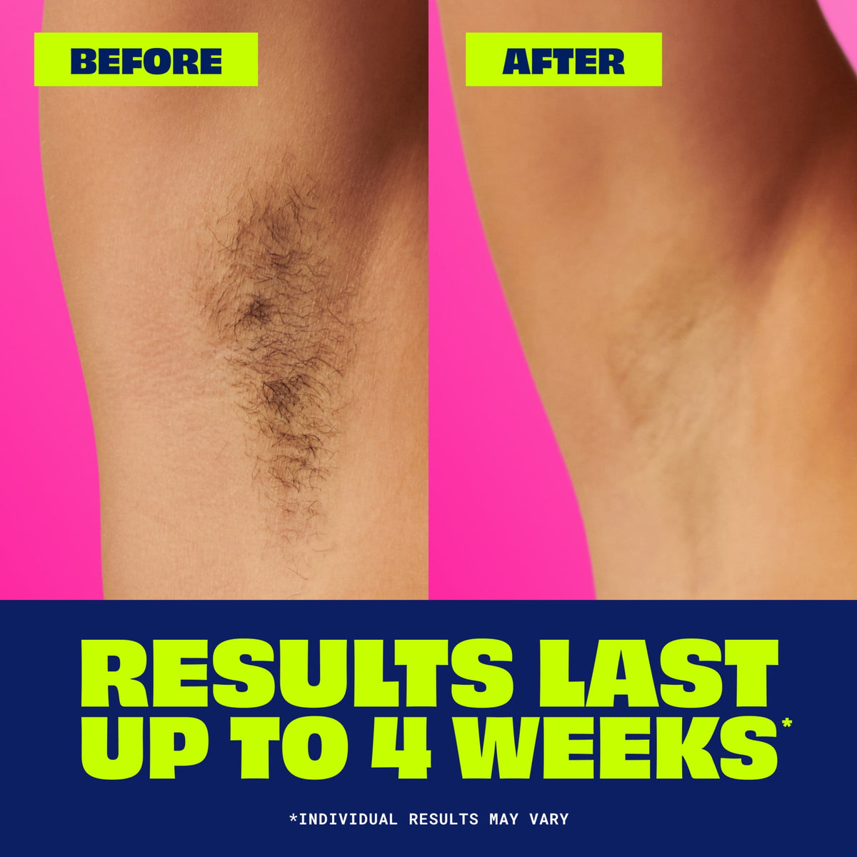 Nair Wax Ready Strips, Hair Removal Wax Strips For Legs and Body, 40 Count Plus 6 Post Wipes