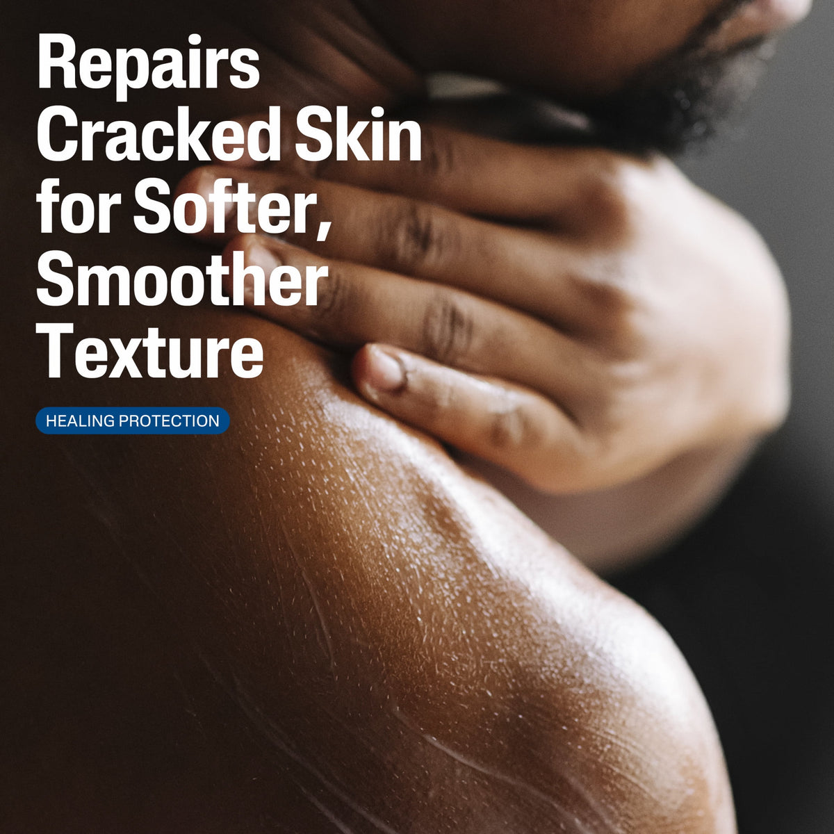 Cetaphil Skin Repair Lotion for Very Rough Cracked Skin, Unscented, 16 fl oz