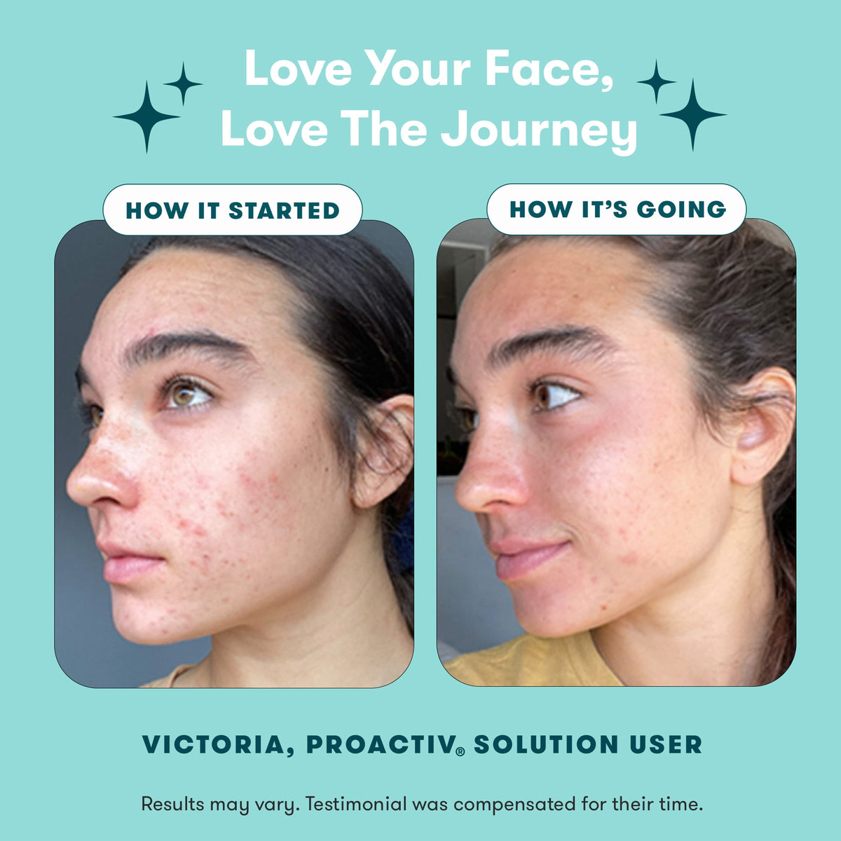 Proactiv Original 3-Step System for Clear Skin