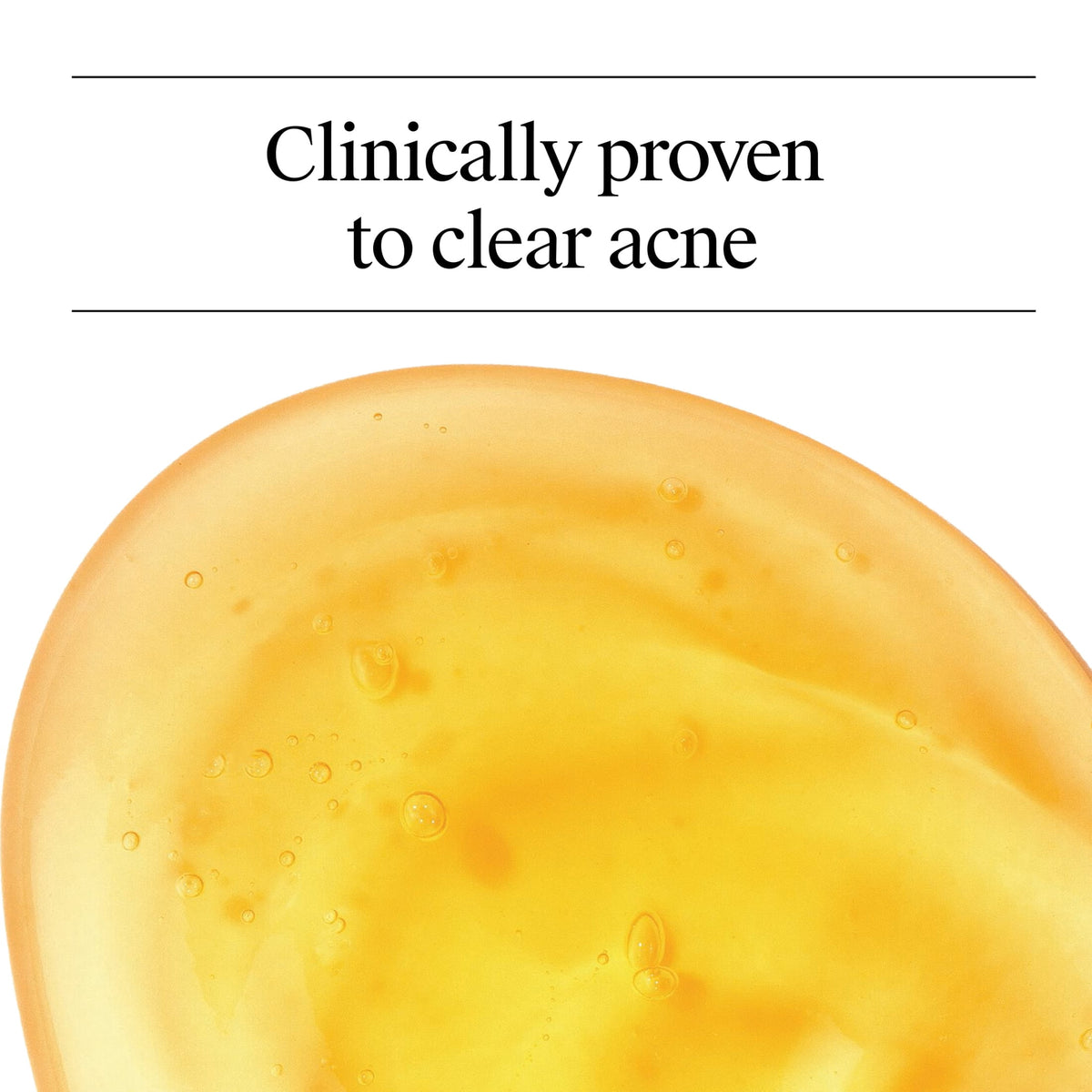 Neutrogena Oil-Free Acne Face Wash, Salicylic Acid Facial Cleanser & Acne Treatment, 9.1 fl oz