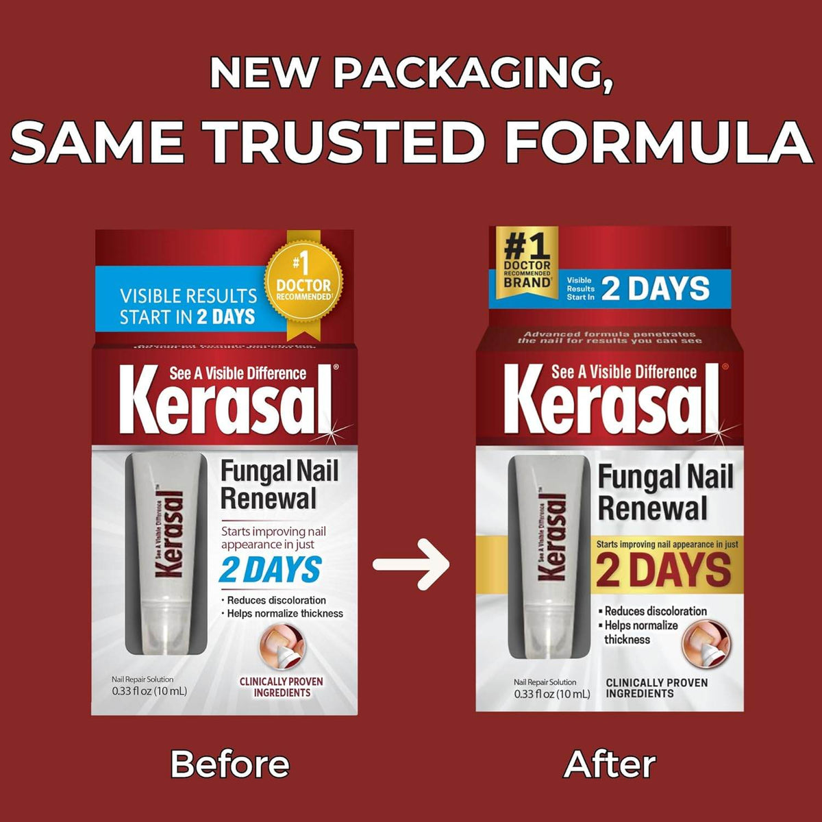 Kerasal Nail Fungal Nail Renewal Treatment, 3 month supply, 0.33 oz - OTC Shoppe Express