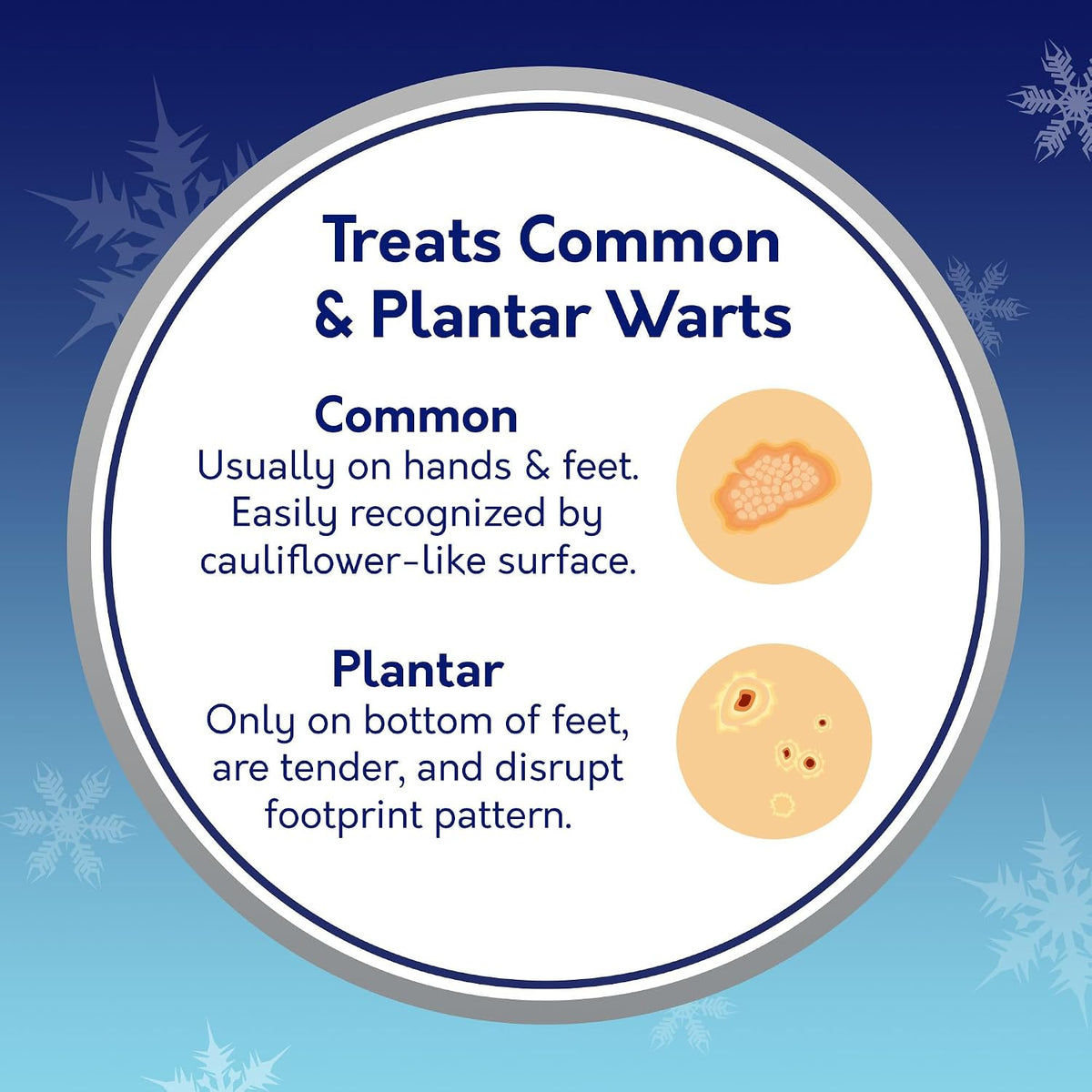 Compound W Freeze Off Wart Remover, 8 Applications