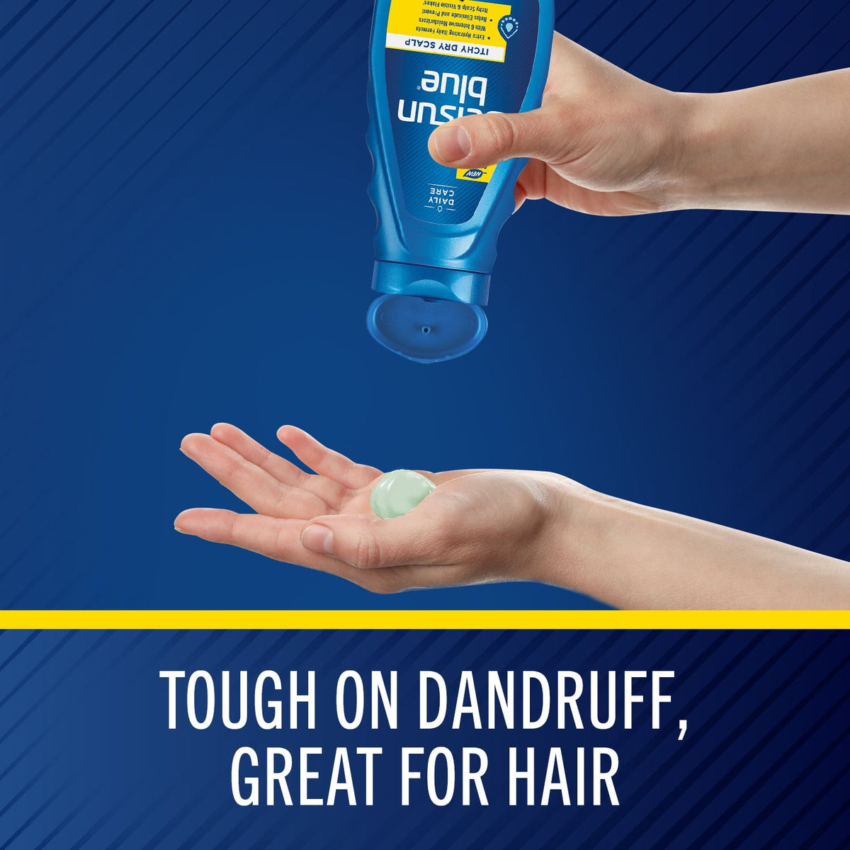 Selsun Blue Itchy Dry Scalp Antidandruff Shampoo, 11 fl. oz.