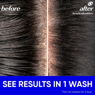 Head & Shoulders 2-in-1 Dandruff Shampoo and Conditioner, Anti-Dandruff Treatment, Classic Clean for Daily Use, Paraben-Free - 20.7 fl oz