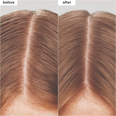 Briogeo Hair Care Scalp Revival Charcoal + Biotin Dry Shampoo - 1.7 fl oz - Beauty Studio