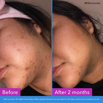 Good Molecules Discoloration Correcting Face Serum - 1 fl oz