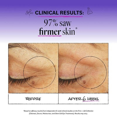 derma e Stem Cell Eye Lifting Treatment – 0.5 oz