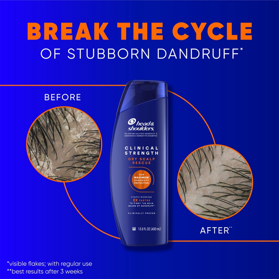 Head and Shoulders Dandruff Shampoo, Clinical Strength Dry Scalp Rescue, with 1% Selenium Sulfide, 13.5 fl oz