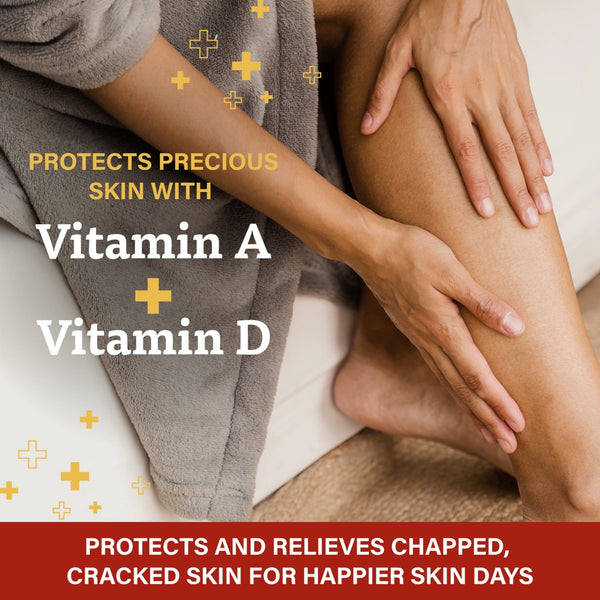 A+D First Aid Ointment Dry Skin Moisturizer and Skin Protectant with Vitamins, 1.5 oz