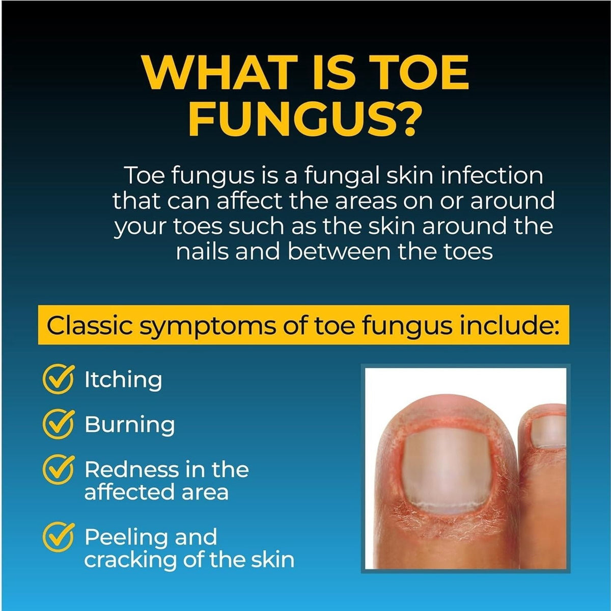 Fungi-Nail Pen Applicator Anti-Fungal Solution 0.101 Fl Oz
