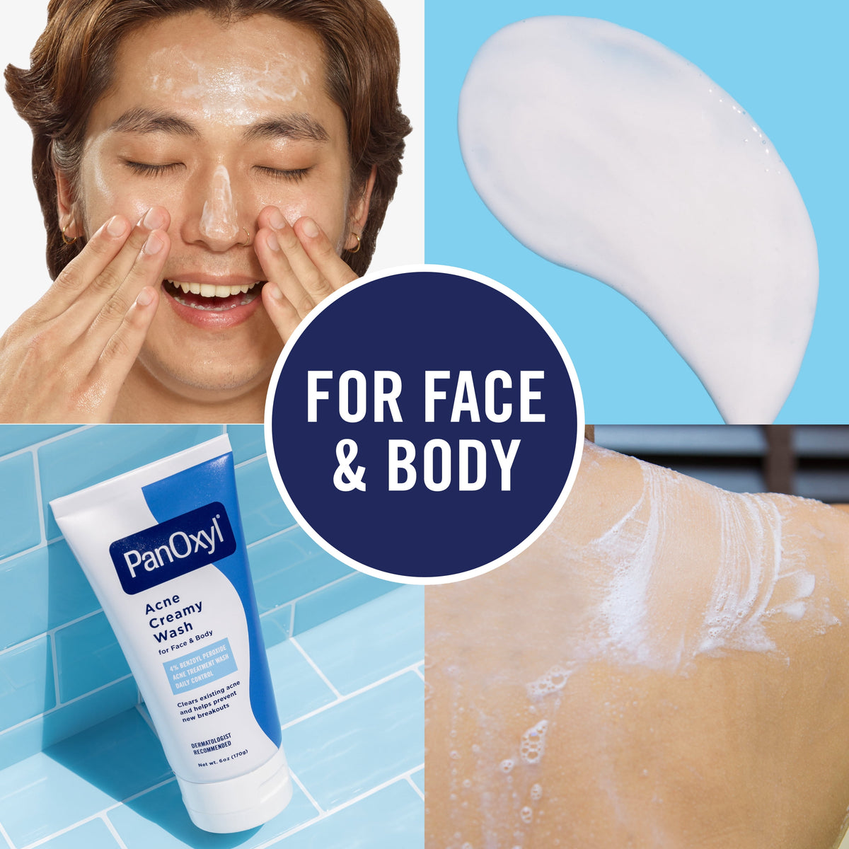 PanOxyl 4% Benzoyl Peroxide Acne Creamy Wash, Clear Acne, 6.0 Oz